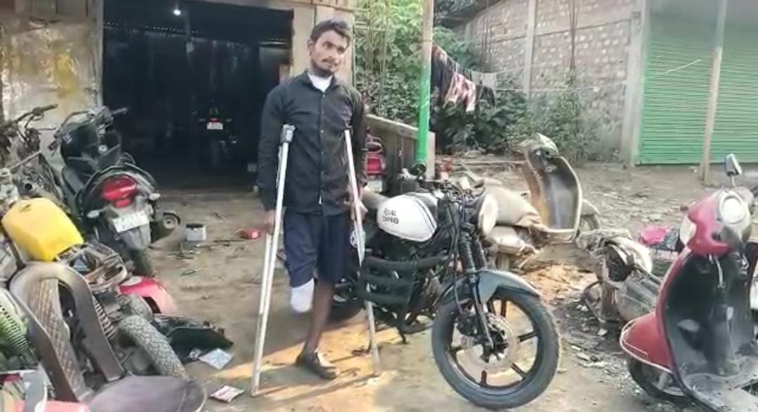 Meet Silchar boy who didn't give up after accident; Modified Pulsar